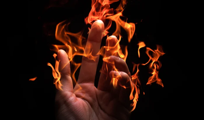 Burn Risks Safety Measures and Precautions