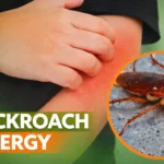 child-allergic-cockroaches-fast-removal